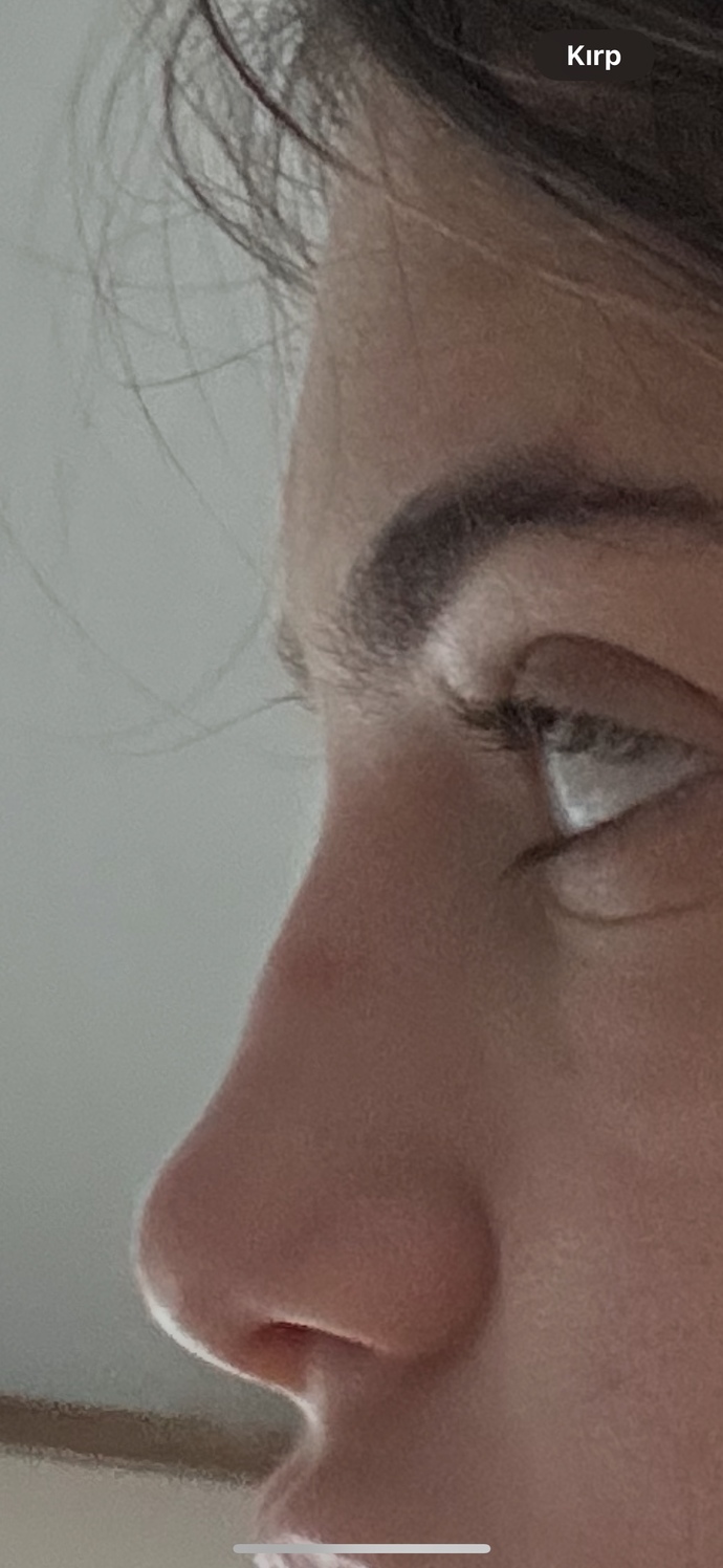 Burnumun sırt kısmı eğri mi duruyor?