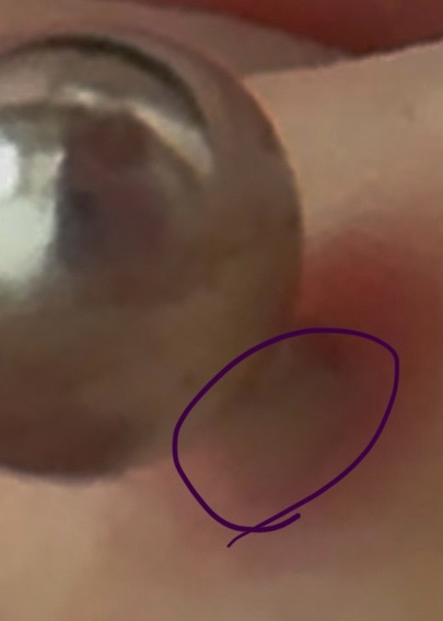 Piercing bakımı hakkında bilgisi olan lütfen detayı okuyabilir mi?