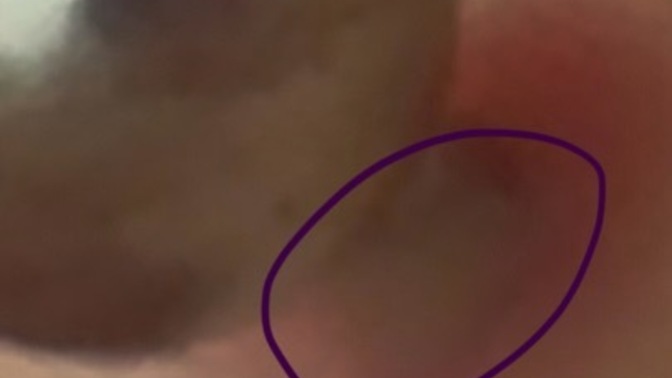 Piercing bakımı hakkında bilgisi olan lütfen detayı okuyabilir mi?