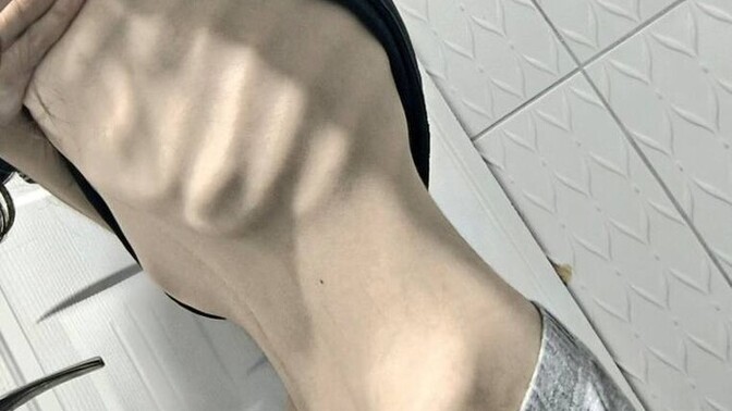 Zayifliktan karnımı icine cekince böyle oluyor sizdede böyle mi?