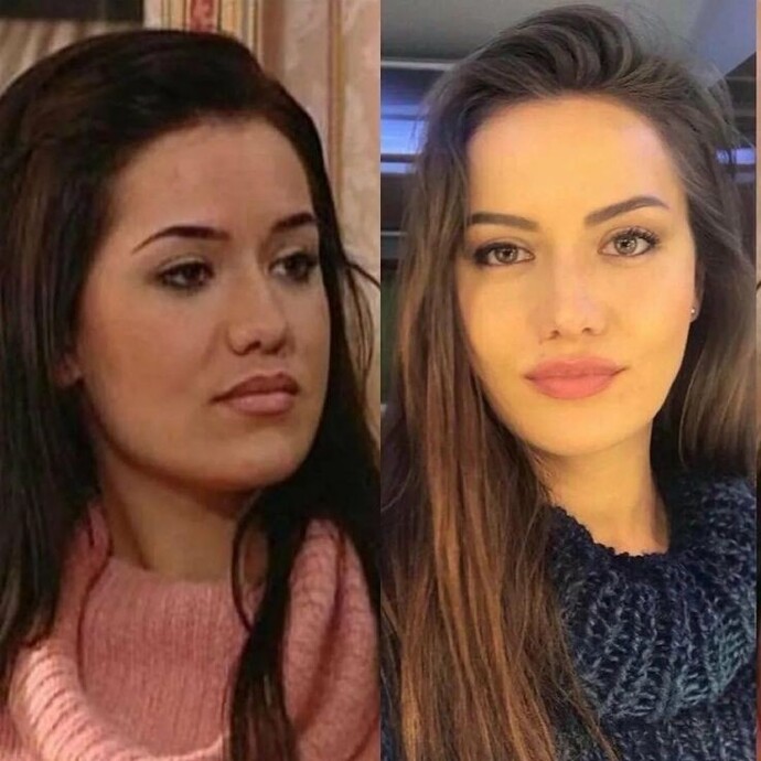 Estetik güzelleştirir mi?