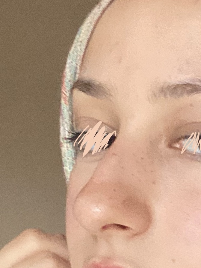 Burnumdaki kemer çok göze batıyor mu?