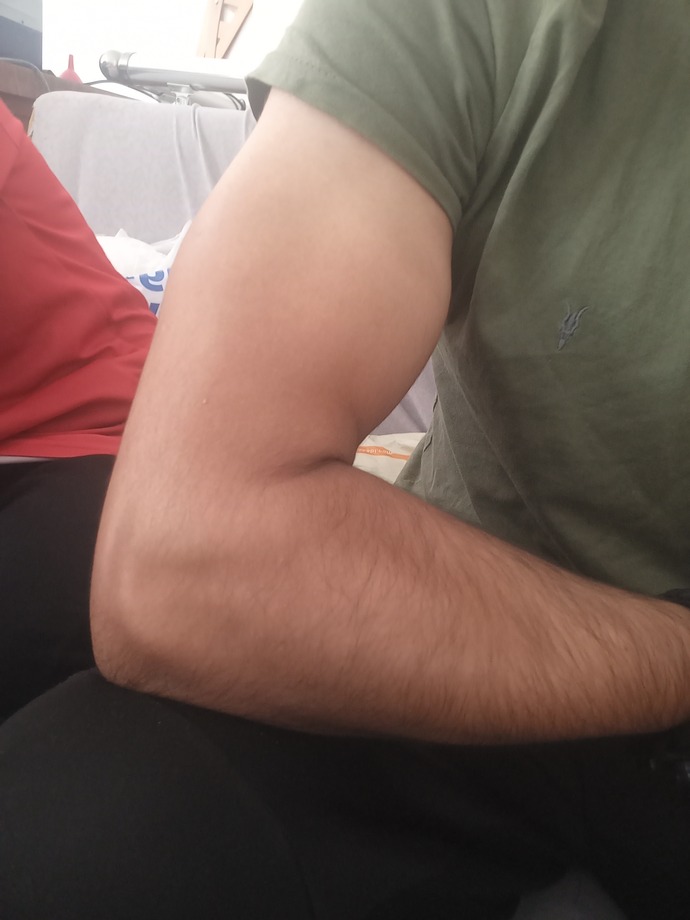 9 aydır spor yapıyom düzgün kol büyütemedim önerisi olan var mı?