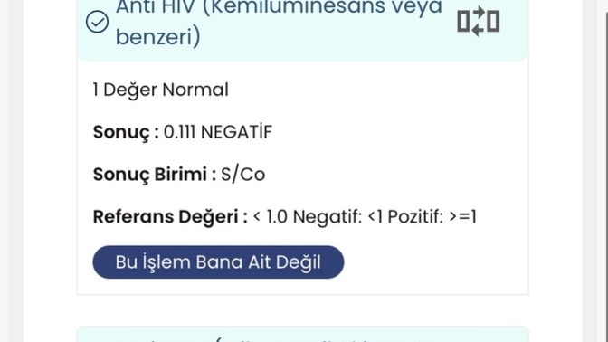 Bu Hiv testim pozitif mi?