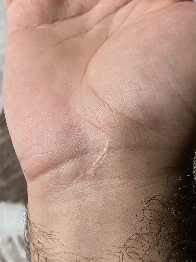 Her bir yaranın bir hikayesi mi vardır ?