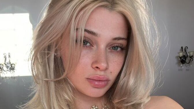 Son zamanlarda dolguları eritmek neden moda oldu?