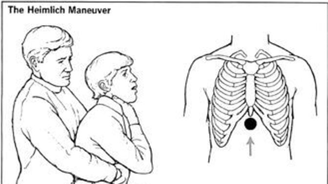Heimlich manevrası yapmasını biliyor musunuz?