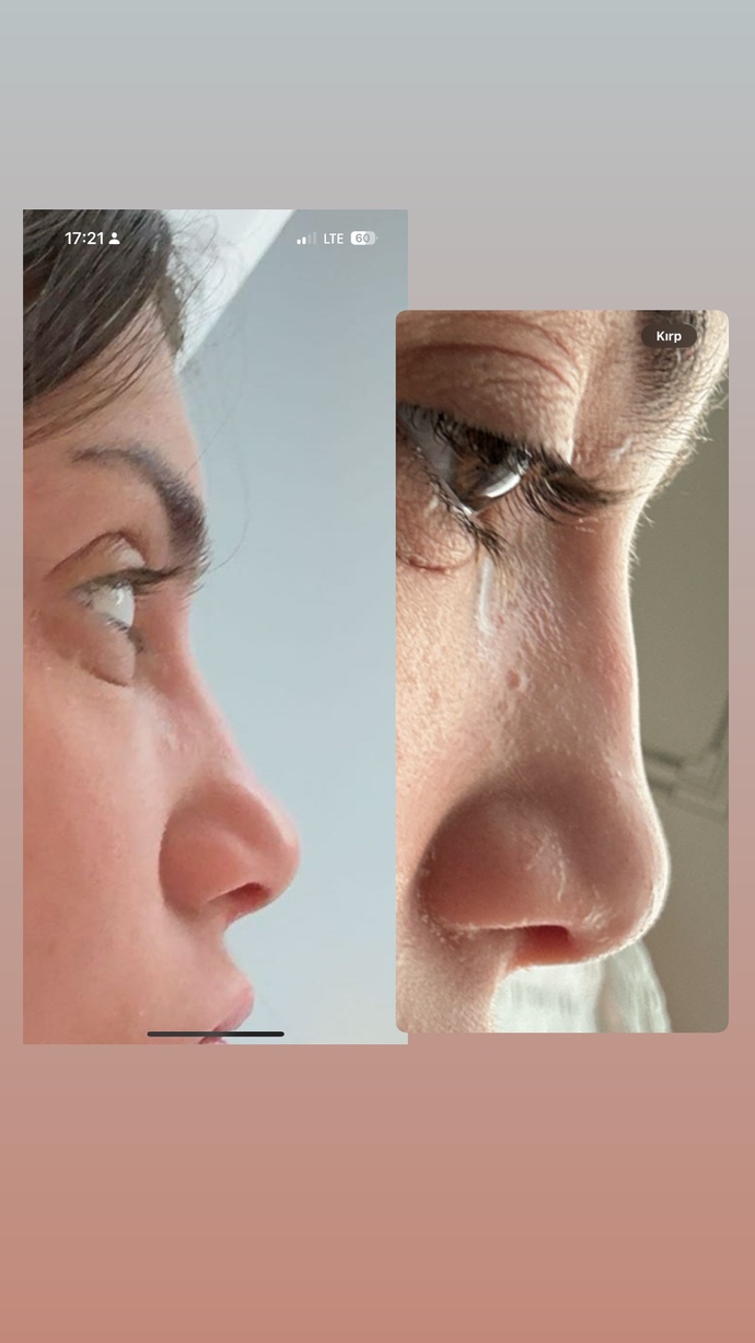 Burnum çok küçük değil mi🥰?