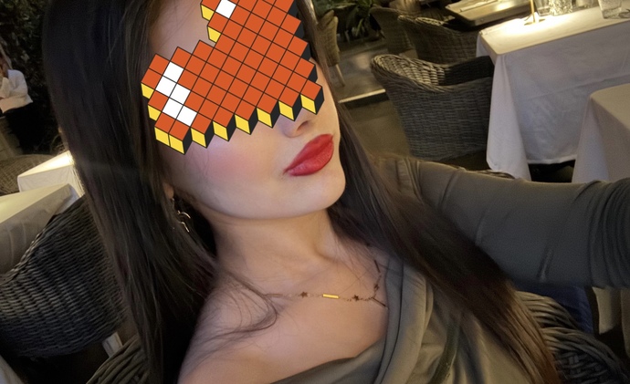 Sizce bana dudak dolgusu gerekiyor mu?