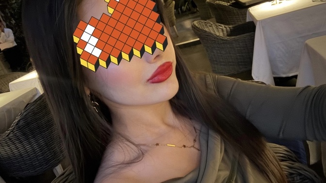 Sizce bana dudak dolgusu gerekiyor mu?