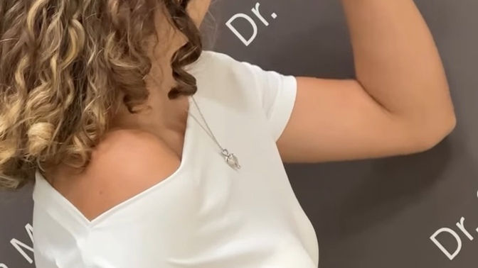Sizce de burun estetiği insanı çok fazla değiştirmiyor mu?