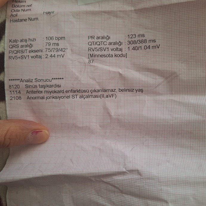 Ekg normal mi arkadaslar?