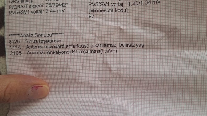 Ekg normal mi arkadaslar?