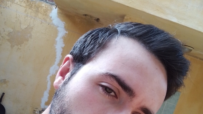 Sakal niye böyle dikenliymiş gibi durur?