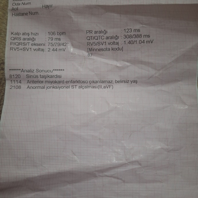 Aekadaşlar bu ekg normal mi?