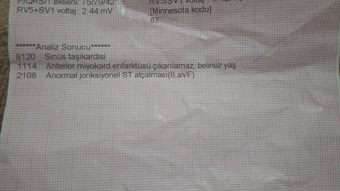 Aekadaşlar bu ekg normal mi?