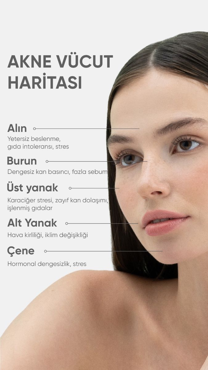 En son ne zaman sivilceniz çıktı?