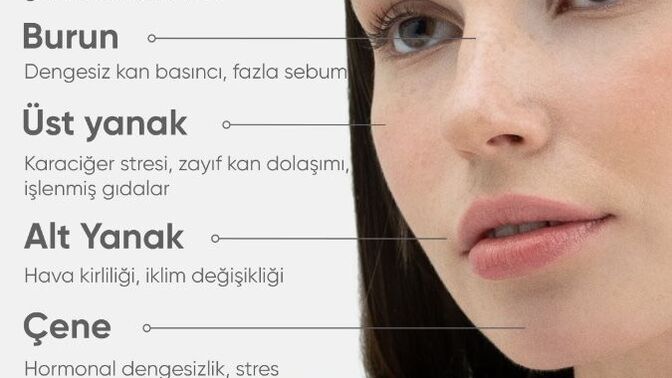 En son ne zaman sivilceniz çıktı?