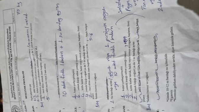 Bu diyet listesiyle nasıl kilo vereceğim, liste çok saçma geliyor, ara öğünler illa olmalı mı?