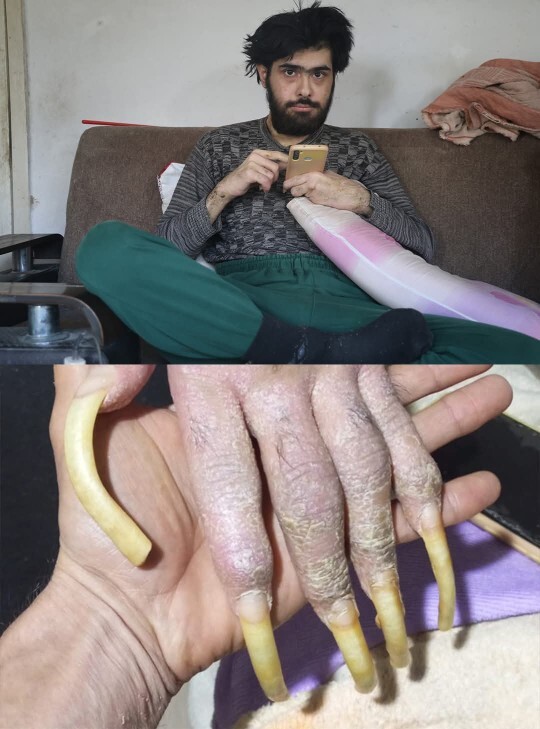 Sizce telefona bakan herkesin sonu bu mu olucak?