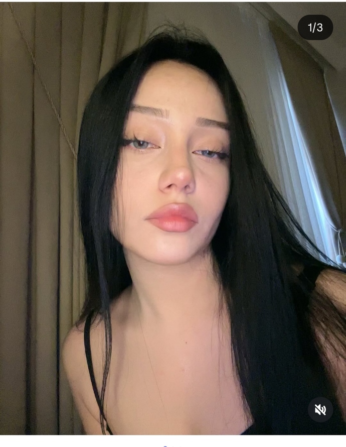 Etraf şu kızlardan dolmadı mi Instagramda hep bunlar var aynı doktora mi gidiyorlar😂?