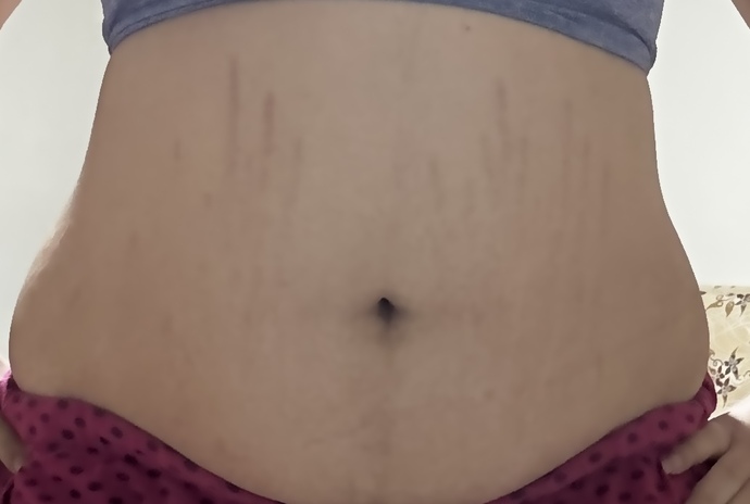 Bu göbekle bikini?