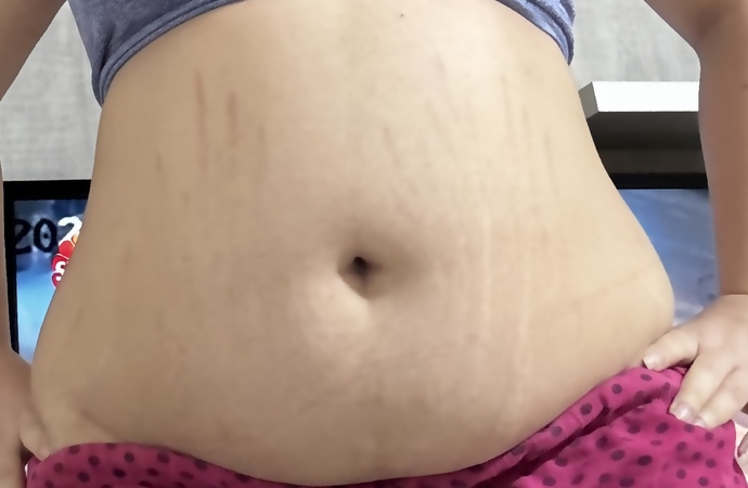 Bu göbekle bikini?