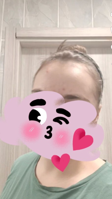 Küçük alınlı kızlar neden beğenmiyorsunuz alnınızı?