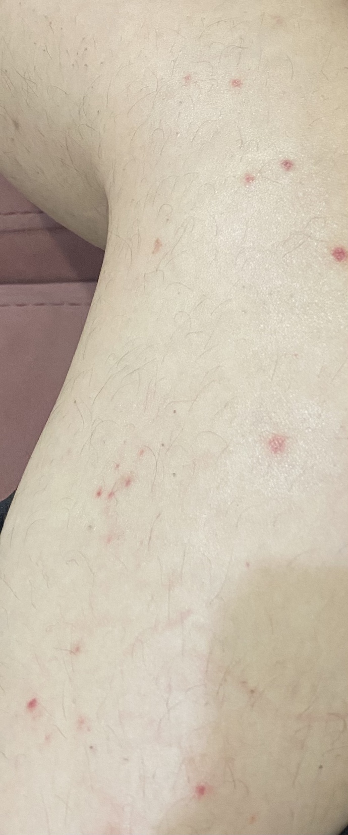 Sizce bu izler nedir sizde de var mıydı?