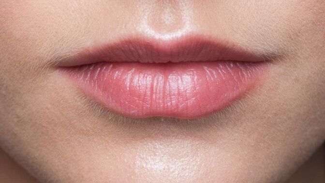 Botokslu dolgun dudaklar mı yoksa doğal ince dudaklar mı?