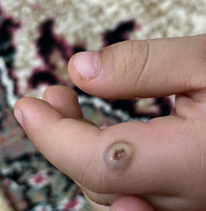 Bu nedir hiç yaşayan oldu mu?