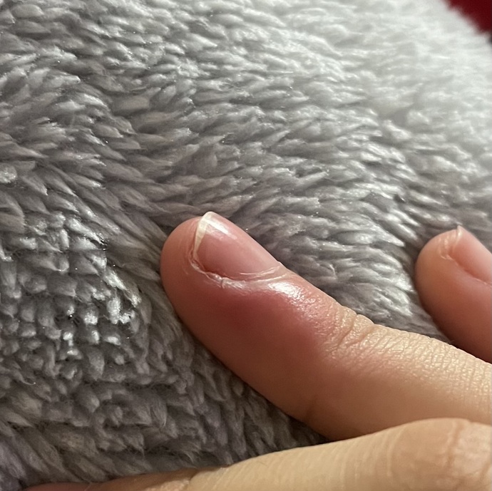 Çok sızlıyor ne yapmam lazım acill?