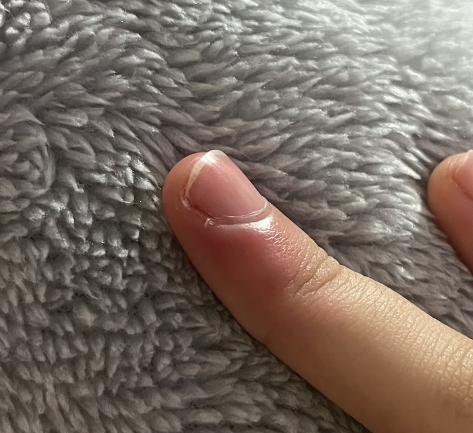 Çok sızlıyor ne yapmam lazım acill?