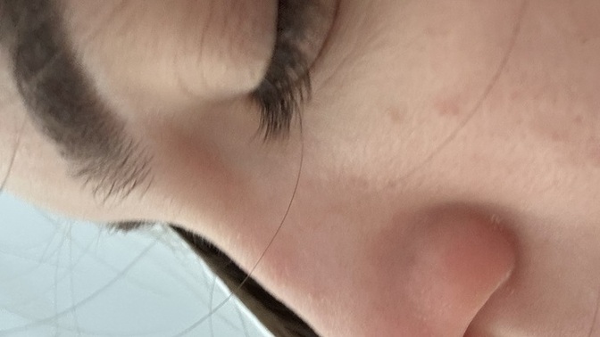 Burnum çıkıntili mi?