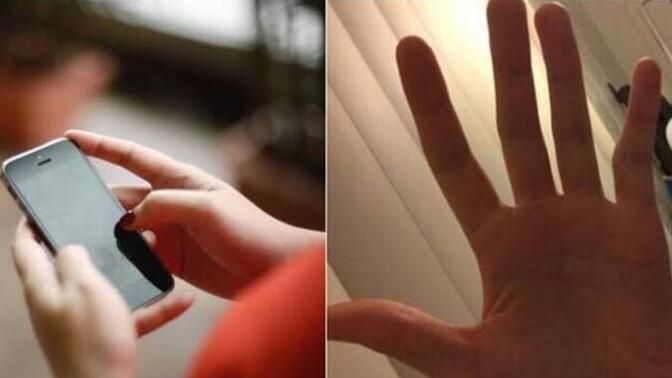 Cep telefonunuzu tutmaktan serçe parmağınız yamuldumu?
