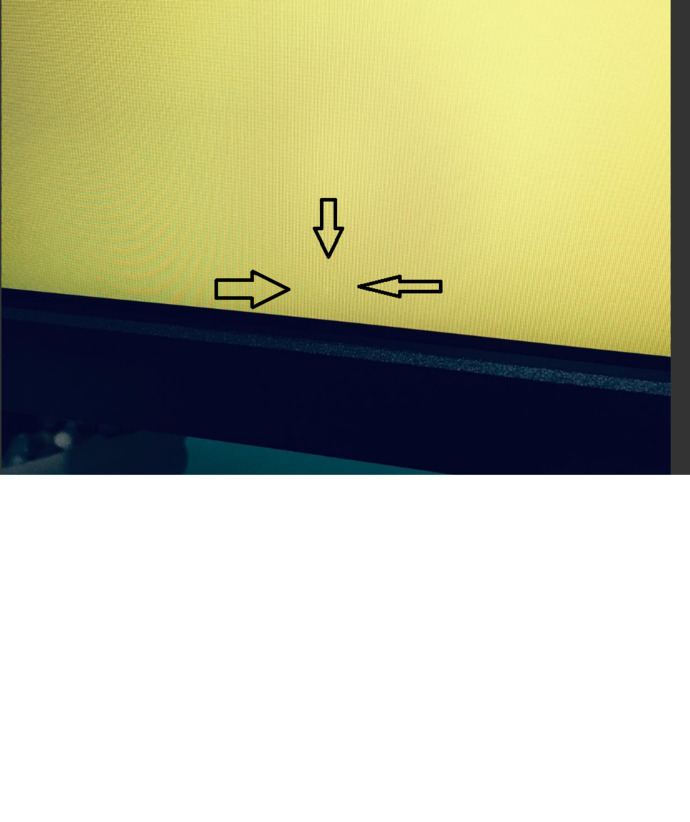 ARKADAŞLAR ASUS MONİTÖR ALDIM BU ÖLÜ PİKSEL Mİ NEDİR?