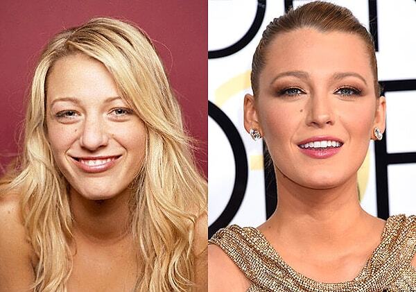 Blake Lively