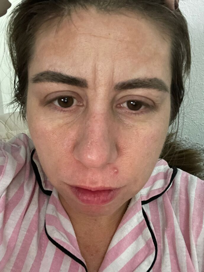 Bu cildim nasıl düzelir, çok mu yaşlı durmuşum?