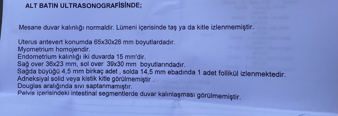 Anlayan var mı bundan?