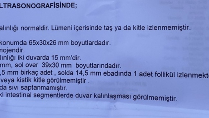 Anlayan var mı bundan?