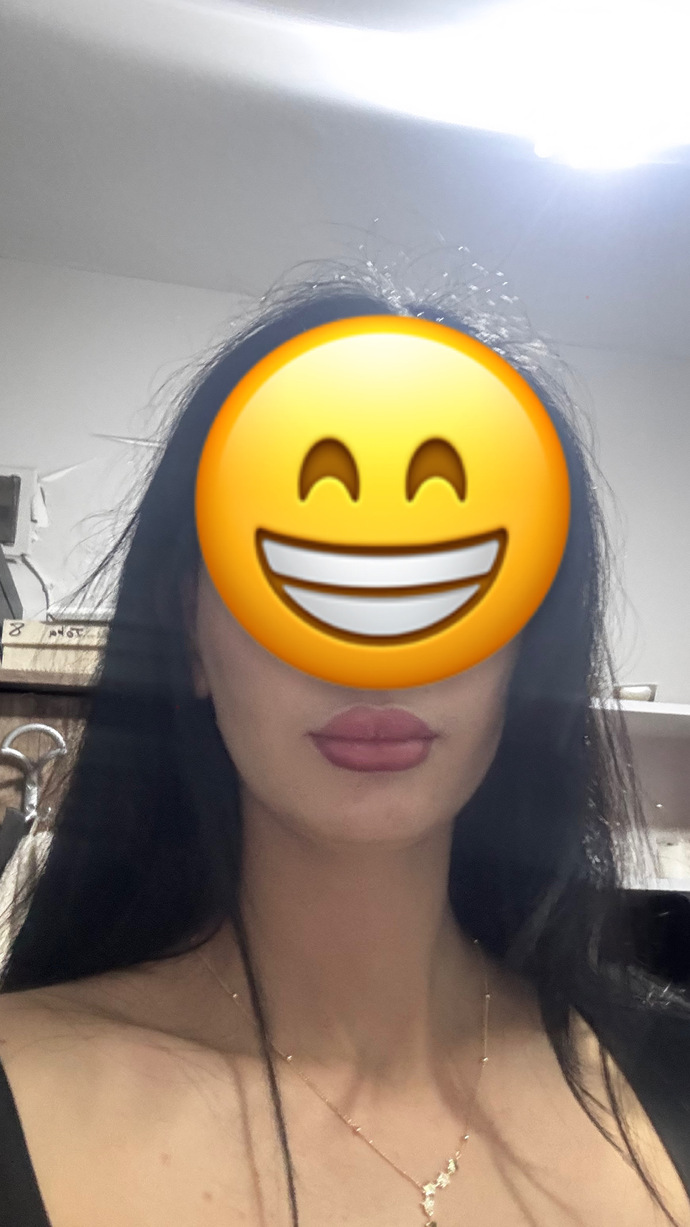 Dudaklarım abartı mı duruyor?