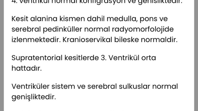 Bunu biri açıklayabilirmi?