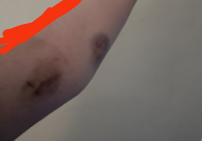 Erkek arkadaşım tarafından dövüldüm ve bu hale geldim ona bıçak çektim ama yaralamadım ceza alır mıyım?
