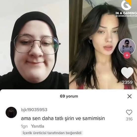 Zayıfım ama yüzüm çok tombul bu çekiciliği azaltir mi?