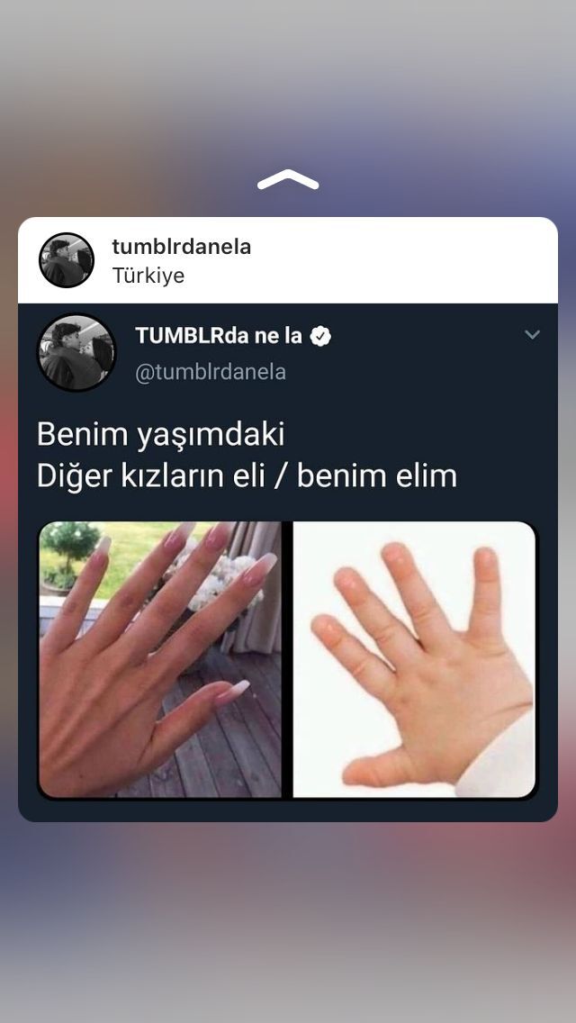 Sizinde elleriniz böyle mi?