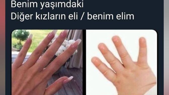Sizinde elleriniz böyle mi?