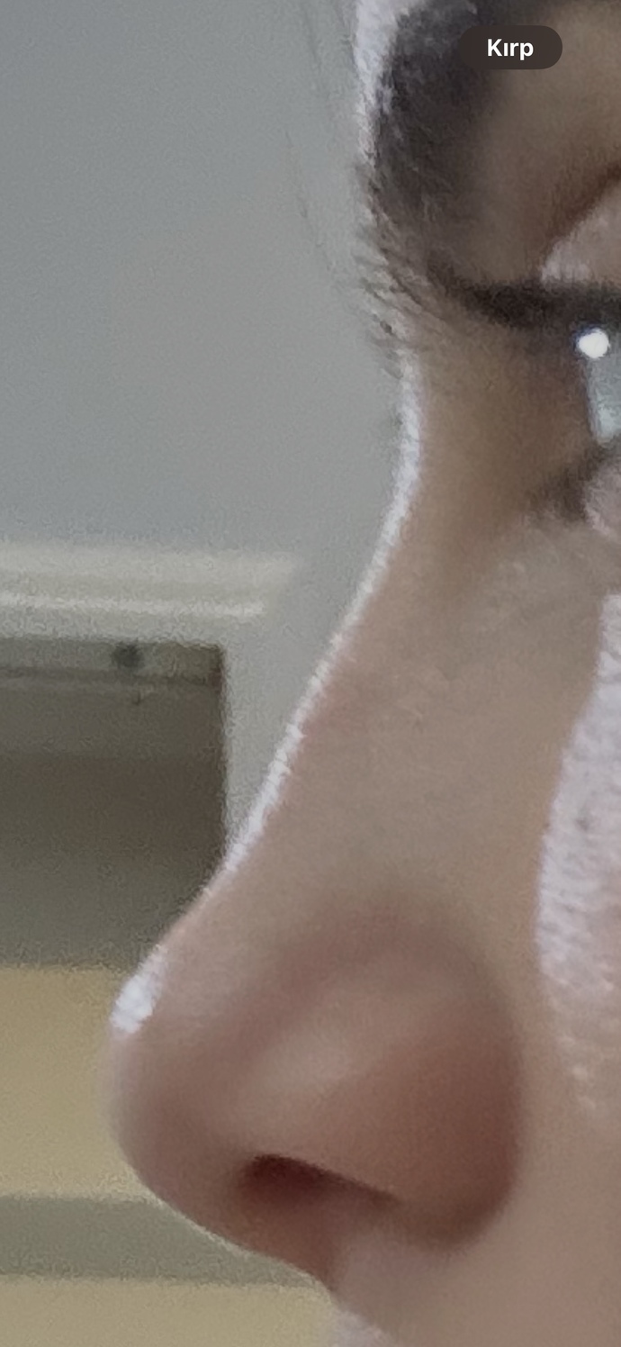 Burnumda kemer var mi?