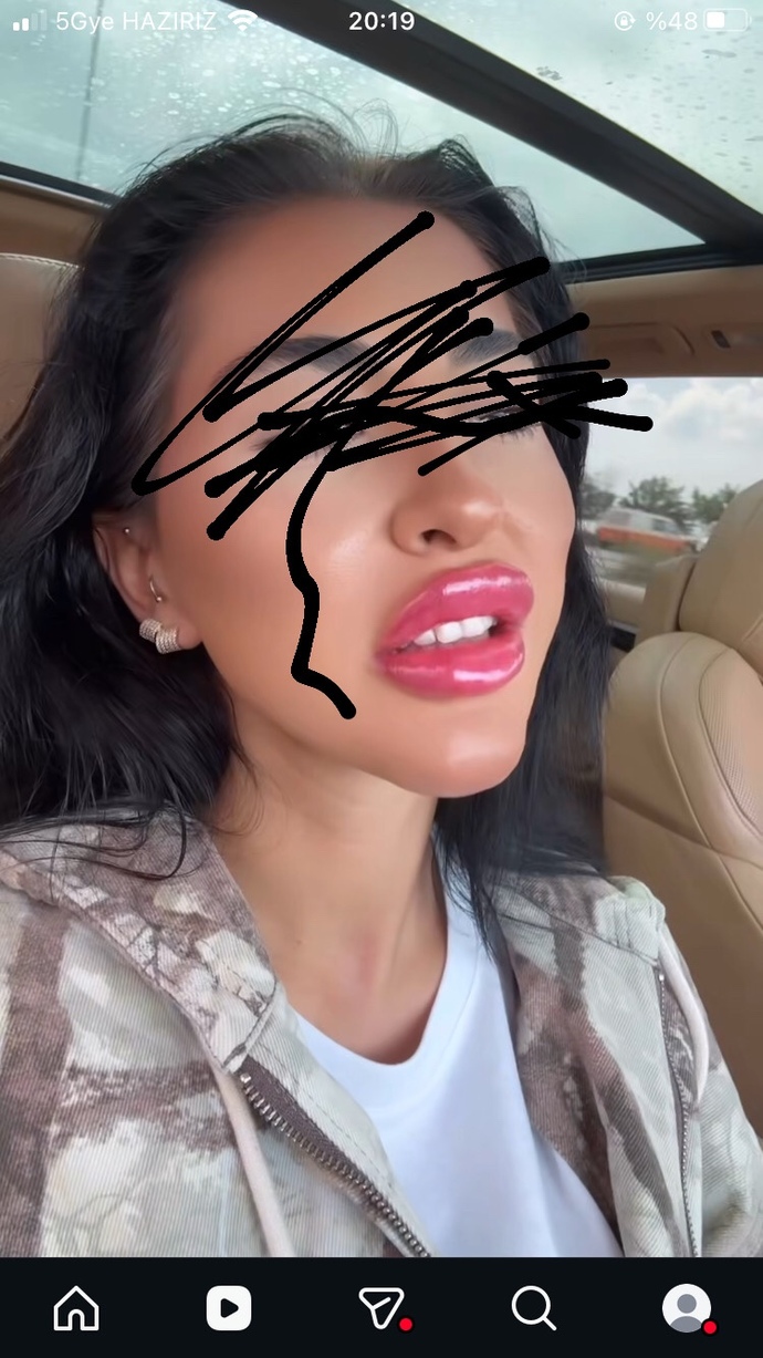 Bu tarz dolguları hoş buluyor musunuz?