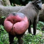 Bu tarz dolguları hoş buluyor musunuz?