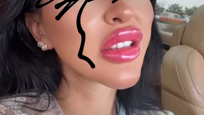 Bu tarz dolguları hoş buluyor musunuz?